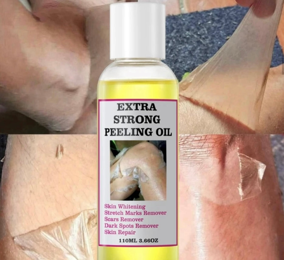 Extra strength, yellow, peeling oil